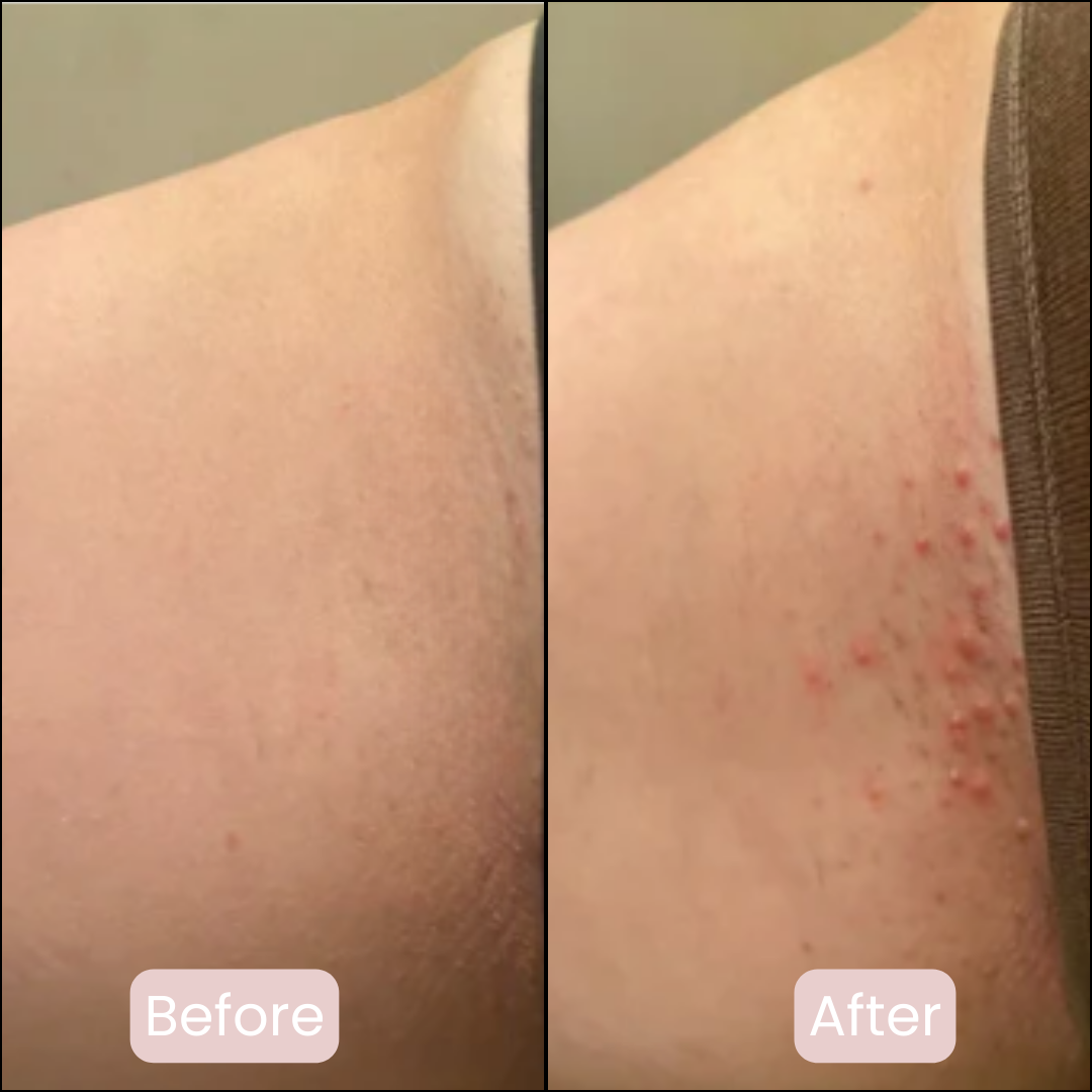 Pure Femmes | Safety Razor | Premium set