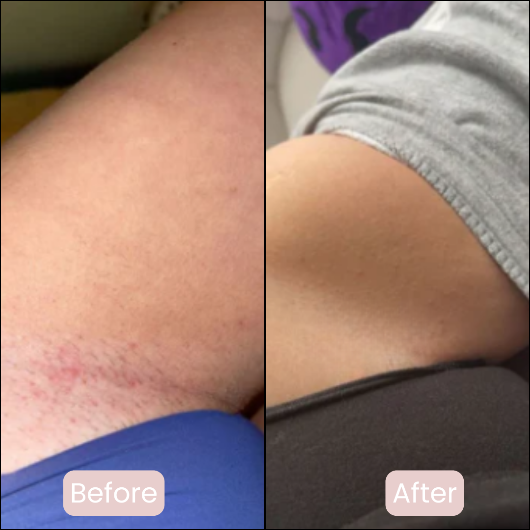 Pure Femmes | Safety Razor | Premium set