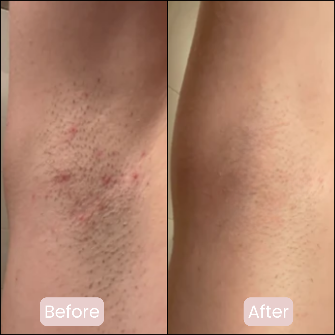 Pure Femmes | Safety Razor | Premium set