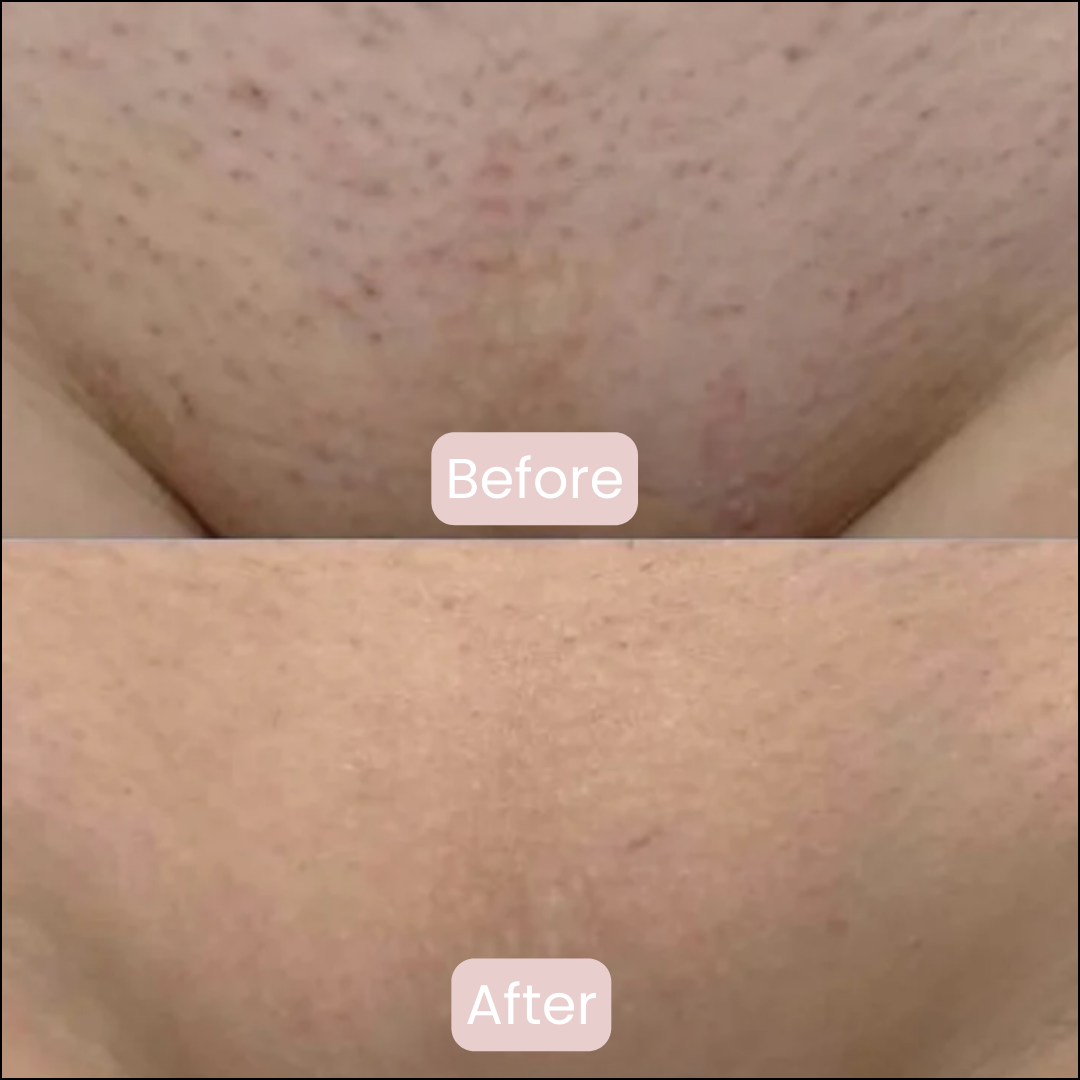 Pure Femmes | Safety Razor | Premium set